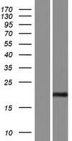 C1orf61 Protein - Western validation with an anti-DDK antibody * L: Control HEK293 lysate R: Over-expression lysate