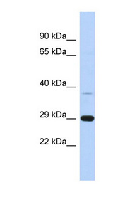 C1orf74 Antibody - C1orf74 antibody Western blot of Fetal Brain lysate. This image was taken for the unconjugated form of this product. Other forms have not been tested.