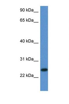 C1orf93 Antibody - 2810405K02Rik antibody Western blot of Mouse Thymus lysate. Antibody concentration 1 ug/ml.  This image was taken for the unconjugated form of this product. Other forms have not been tested.