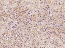 C1orf93 Antibody - Immunochemical staining of human C1orf93 in human adrenal gland with rabbit polyclonal antibody at 1:500 dilution, formalin-fixed paraffin embedded sections.
