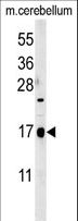 C1orf95 Antibody - CA095 Antibody western blot of mouse cerebellum tissue lysates (35 ug/lane). The CA095 antibody detected CA095 protein (arrow).