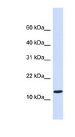 C1orf95 Antibody - C1orf95 antibody Western blot of Fetal Heart lysate. This image was taken for the unconjugated form of this product. Other forms have not been tested.