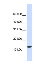 C1orf95 Antibody - C1orf95 antibody Western blot of Fetal Heart lysate. This image was taken for the unconjugated form of this product. Other forms have not been tested.