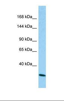 C1QDC1 / Caprin-2 Antibody - Western blot of Human A549. CAPRIN2 antibody dilution 1.0 ug/ml.  This image was taken for the unconjugated form of this product. Other forms have not been tested.