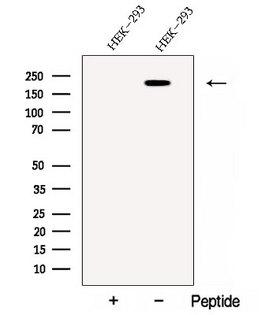 C1QDC1 / Caprin-2 Antibody - Western blot analysis of extracts of HEK293 cells using CAPRIN2 antibody. The lane on the left was treated with blocking peptide.
