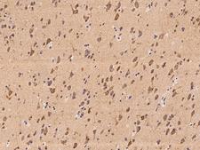 C1QDC1 / Caprin-2 Antibody - Immunochemical staining of human CAPRIN2 in human brain with rabbit polyclonal antibody at 1:100 dilution, formalin-fixed paraffin embedded sections.