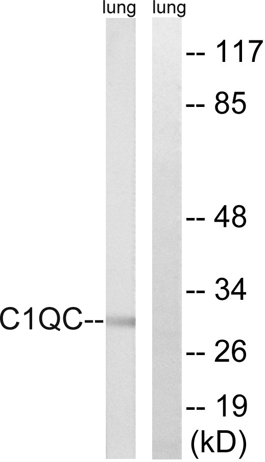 C1QG / Complement C1QC Antibody - Western blot analysis of lysates from rat lung, using C1QC Antibody. The lane on the right is blocked with the synthesized peptide.