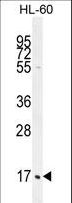 C1QG / Complement C1QC Antibody - C1QC Antibody western blot of HL-60 cell line lysates (35 ug/lane). The C1QC antibody detected the C1QC protein (arrow).