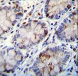 C1QG / Complement C1QC Antibody - C1QC Antibody immunohistochemistry of formalin-fixed and paraffin-embedded human rectum tissue followed by peroxidase-conjugated secondary antibody and DAB staining.