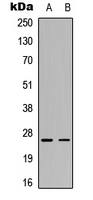C1QG / Complement C1QC Antibody - Western blot analysis of C1QG expression in HeLa (A); rat muscle (B) whole cell lysates.