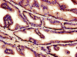 C1QG / Complement C1QC Antibody - Immunohistochemistry image of paraffin-embedded human prostate tissue at a dilution of 1:100