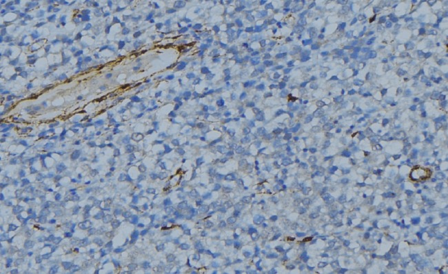 C1QG / Complement C1QC Antibody - 1:100 staining human uterus tissue by IHC-P. The sample was formaldehyde fixed and a heat mediated antigen retrieval step in citrate buffer was performed. The sample was then blocked and incubated with the antibody for 1.5 hours at 22°C. An HRP conjugated goat anti-rabbit antibody was used as the secondary.