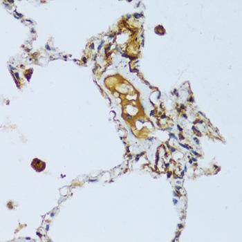 C1QG / Complement C1QC Antibody - Immunohistochemistry of paraffin-embedded Human lung using C1QC Polyclonal Antibody at dilution of 1:100 (40x lens).