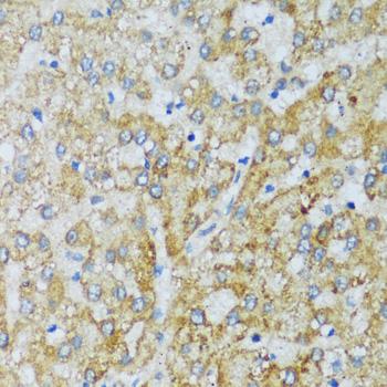 C1QG / Complement C1QC Antibody - Immunohistochemistry of paraffin-embedded Human liver using C1QC Polyclonal Antibody at dilution of 1:100 (40x lens).