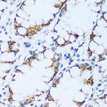 C1QG / Complement C1QC Antibody - Immunohistochemistry of paraffin-embedded Human colon using C1QC Polyclonal Antibody at dilution of 1:100 (40x lens).