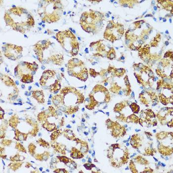 C1QG / Complement C1QC Antibody - Immunohistochemistry of paraffin-embedded Human stomach using C1QC Polyclonal Antibody at dilution of 1:100 (40x lens).