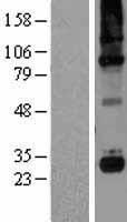 C1QG / Complement C1QC Protein - Western validation with an anti-DDK antibody * L: Control HEK293 lysate R: Over-expression lysate