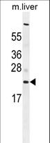 C1QL3 Antibody - C1QL3 Antibody western blot of mouse liver tissue lysates (35 ug/lane). The C1QL3 antibody detected the C1QL3 protein (arrow).