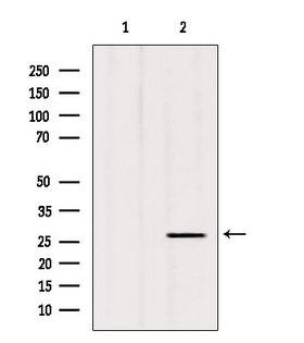 C1QL3 Antibody - Western blot analysis of extracts of various samples using C1QL3 antibody. Lane 1: 293 treated with blocking peptide. Lane 2: 293; Lane 3: HeLa;