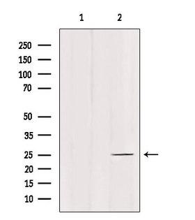 C1QL4 Antibody - Western blot analysis of extracts of mouse brain tissue using C1QL4 antibody. Lane 1 was treated with the blocking peptide.