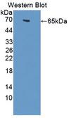 C1qRP / CD93 Antibody - Western blot of C1qRP / CD93 antibody.