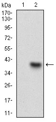 C1qRP / CD93 Antibody - Western blot using CD93 monoclonal antibody against HEK293 (1) and CD93 (AA: 474-535)-hIgGFc transfected HEK293 (2) cell lysate.