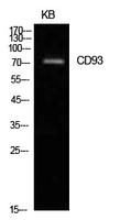 C1qRP / CD93 Antibody - Western Blot analysis of extracts from KB cells using CD93 Antibody.