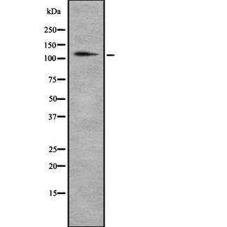 C1qRP / CD93 Antibody - Western blot analysis of CD93 using HeLa whole cells lysates