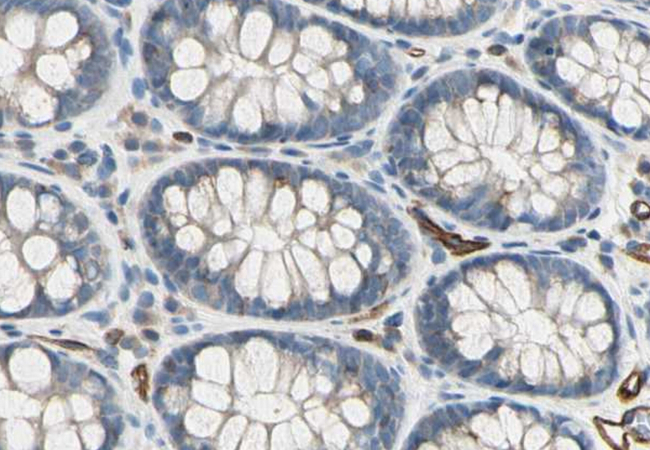C1qRP / CD93 Antibody - 1/100 staining human colon by IHC-P. The sample was formaldehyde fixed and a heat mediated antigen retrieval step in citrate buffer was performed. The sample was then blocked and incubated with the antibody for 1.5 hours at 22°C. An HRP conjugated goat anti-rabbit antibody was used as the secondary antibody.