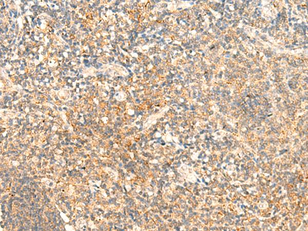 C1qRP / CD93 Antibody - Immunohistochemistry of paraffin-embedded Human tonsil tissue  using CD93 Polyclonal Antibody at dilution of 1:50(×200)