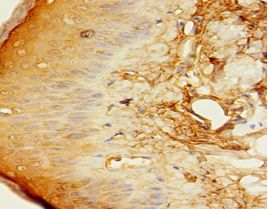 C1QTNF1 / CTRP1 Antibody - Immunohistochemistry of paraffin-embedded human skin tissue using antibody at 1:100 dilution.  This image was taken for the unconjugated form of this product. Other forms have not been tested.