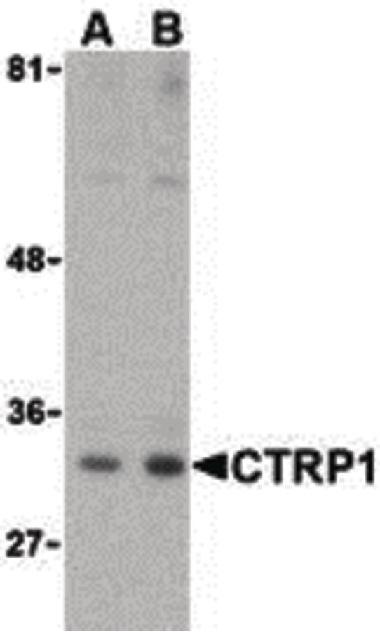 C1QTNF1 / CTRP1 Antibody - Western blot of CTRP1 in MDA-MD-361 cell lysate with CTRP1 (IN) antibody at (A) 1 and (B) 2 ug/ml.