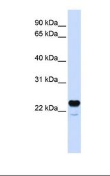 C1QTNF1 / CTRP1 Antibody - Fetal brain lysate. Antibody concentration: 1.0 ug/ml. Gel concentration: 12%.  This image was taken for the unconjugated form of this product. Other forms have not been tested.
