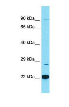 C1QTNF12 Antibody - Western blot of MCF7. FAM132A antibody dilution 1.0 ug/ml.  This image was taken for the unconjugated form of this product. Other forms have not been tested.