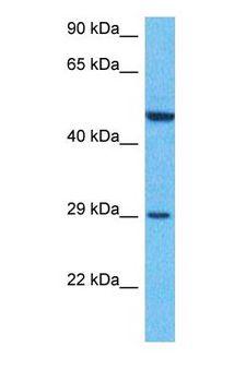 C1QTNF2 / CTRP2 Antibody - Western blot of C1QT2 Antibody with human Stomach Tumor lysate.  This image was taken for the unconjugated form of this product. Other forms have not been tested.