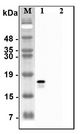 C1QTNF2 / CTRP2 Antibody - Western blot analysis of recombinant human CTRPs using anti-CTRP2 (human), pAb at 1:4,000 dilution.1: Recombinant human CTRP2 protein (His-tagged).2: Unrelated recombinant protein (His-tagged).