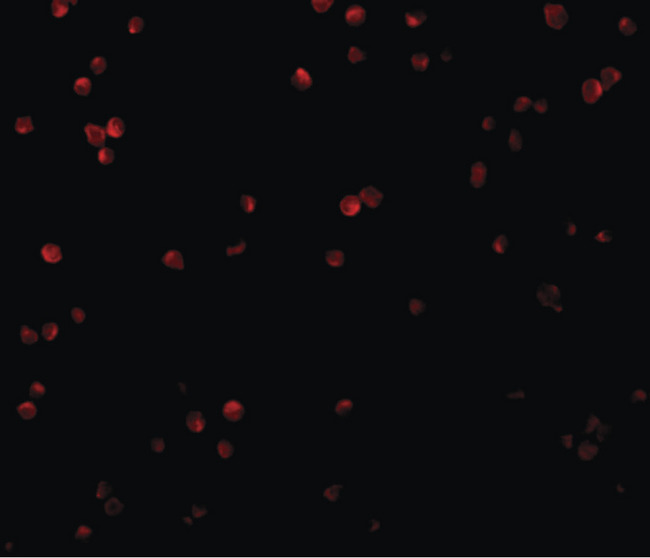 C1QTNF2 / CTRP2 Antibody - Immunofluorescence of CTRP2 in Jurkat cells with CTRP2 antibody at 20 ug/ml.