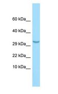 C1QTNF3 / CTRP3 Antibody - C1QTNF3 / CTRP3 antibody Western Blot of MCF7.  This image was taken for the unconjugated form of this product. Other forms have not been tested.