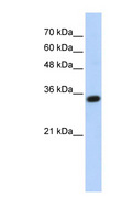 C1QTNF4 / CTRP4 Antibody - C1QTNF4 / CTRP4 antibody Western blot of Transfected 293T cell lysate. This image was taken for the unconjugated form of this product. Other forms have not been tested.