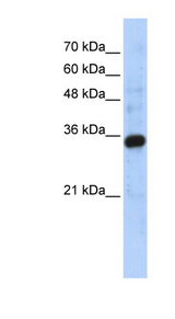 C1QTNF4 / CTRP4 Antibody - C1QTNF4 / CTRP4 antibody Western blot of Transfected 293T cell lysate. This image was taken for the unconjugated form of this product. Other forms have not been tested.