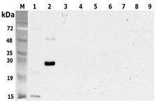 C1QTNF5 / CTRP5 Antibody - Western blot analysis using anti-CTRP5 (human), pAb at 1:5000 dilution. 1: Human CTRP5 (tGD) (His-tagged). 2: Human CTRP5 (His-tagged). 3: Human CTRP5 (GD) (His-tagged) (negative control). 4: Human CTRP6 (His-tagged) (negative control). 5: Human CTRP6 (GD) (His-tagged) (negative control). 6: Human CTRP7 (GD) (His-tagged) (negative control). 7: Human CTRP9 (GD) (His-tagged) (negative control). 8: Human CTRP10 (GD) (His-tagged) (negative control). 9: Mouse FTO (His-tagged) (negative control).