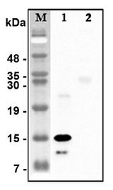 C1QTNF5 / CTRP5 Antibody - Western blot analysis of recombinant human CTRPs using anti-CTRP5 (human), pAb at 1:4,000 dilution.1: Recombinant human CTRP5 protein (His-tagged).2: Unrelated recombinant protein (His-tagged).