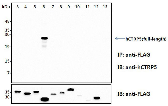 C1QTNF5 / CTRP5 Antibody - Immunoprecipitation (IP) analysis of the cell lysates from HEK293 cells transfected with empty vector or a panel of the FLAG-tagged CTRP family (full-length) followed by immunoblot analysis using anti-CTRP5 (human), pAb at 1:4,000 dilution. The immunoblot (IB) analysis demonstrates the specificity of the anti-CTRP5 (human), pAb antibody. 3: hCTRP1-FLAG (full-length) transfected HEK293 cell lysates. 4: hCTRP2-FLAG (full-length) transfected HEK293 cell lysates. 5: hCTRP3-FLAG (full-length) transfected HEK293 cell lysates. 6: hCTRP5-FLAG (full-length) transfected HEK293 cell lysates.. 7: hCTRP6-FLAG (full-length) transfected HEK293 cell lysates. 8: hCTRP7-FLAG (full-length) transfected HEK293 cell lysates. 9: hCTRP9-FLAG (full-length) transfected HEK293 cell lysates. 10: hCTRP10-FLAG (full-length) transfected HEK293 cell lysates. 11: hCTRP11-FLAG (full-length) transfected HEK293 cell lysates. 12: hCTRP13-FLAG (full-length) transfected HEK293 cell lysates. 13: Empty vector transfected HEK293 cell lysates.