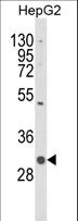 C1QTNF6 / CTRP6 Antibody - Western blot of C1QTNF6 Antibody in HepG2 cell line lysates (35 ug/lane). C1QTNF6 (arrow) was detected using the purified antibody.