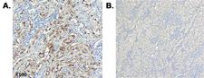 C1QTNF6 / CTRP6 Antibody - Immunohistochemical staining of CTRP6 using anti-CTRP6 (human), mAb (256-E) in human tissue. Method: A. Paraffin-embedded human kidney tissue, showing stained cell cytoplasm using anti-CTRP6 (human), mAb (256-E) at dilution 1:200 (under X100 lens, Brown color). B. Human kidney stained with isotype control IgG1kappa (Negative control, under X100 lens).