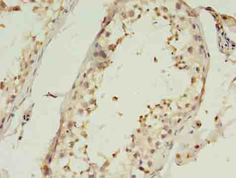 C1QTNF6 / CTRP6 Antibody - Immunohistochemistry of paraffin-embedded human testis tissue using antibody at dilution of 1:100.