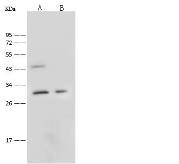 C1QTNF6 / CTRP6 Antibody - Anti-C1QTNF6 rabbit polyclonal antibody at 1:500 dilution. Lane A: Hela Whole Cell Lysate. Lane B: HepG2 Whole Cell Lysate. Lysates/proteins at 30 ug per lane. Secondary: Goat Anti-Rabbit IgG (H+L)/HRP at 1/10000 dilution. Developed using the ECL technique. Performed under reducing conditions. Predicted band size: 29 kDa. Observed band size: 29 kDa.