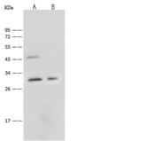 C1QTNF6 / CTRP6 Antibody - Anti-C1QTNF6 rabbit polyclonal antibody at 1:500 dilution. Lane A: Hela Whole Cell Lysate. Lane B: HepG2 Whole Cell Lysate. Lysates/proteins at 30 ug per lane. Secondary: Goat Anti-Rabbit IgG (H+L)/HRP at 1/10000 dilution. Developed using the ECL technique. Performed under reducing conditions. Predicted band size: 29 kDa. Observed band size: 29 kDa.