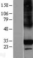 C1QTNF6 / CTRP6 Protein - Western validation with an anti-DDK antibody * L: Control HEK293 lysate R: Over-expression lysate