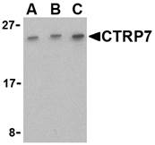 C1QTNF7 / CTRP7 Antibody - Western blot of CTRP7 in 293 cell lysate with CTRP7 antibody at (A) 0.5, (B) 1, and (C) 2 ug/ml.